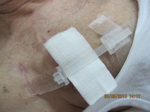 The system is positioned over a bandage